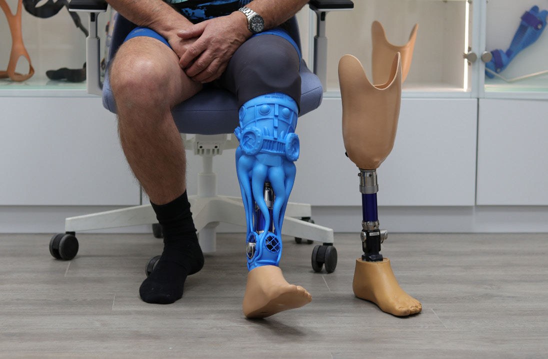 3D Druck im Sanitätshaus Klinz